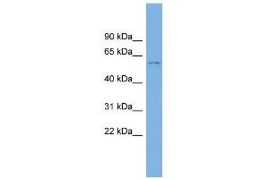 WB Suggested Anti-KIAA1430 Antibody Titration: 0. (CFAP97/KIAA1430 Antikörper  (Middle Region))