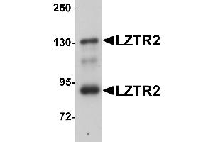 Western Blotting (WB) image for anti-SEC16 Homolog B (SEC16B) (C-Term) antibody (ABIN1030501) (SEC16B Antikörper  (C-Term))