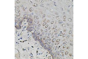 Immunohistochemistry of paraffin-embedded human esophagus using APP antibody. (beta Amyloid Antikörper)