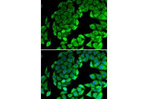 Immunofluorescence analysis of MCF-7 cells using RPL14 antibody (ABIN6291381). (RPL14 Antikörper)