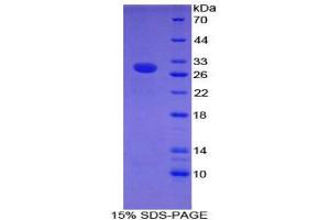 SDS-PAGE (SDS) image for Intercellular Adhesion Molecule 2 (ICAM2) (AA 27-248) protein (His tag) (ABIN2125355) (ICAM2 Protein (AA 27-248) (His tag))