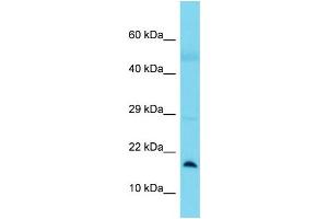 Host:  Rabbit  Target Name:  BLOC1S1  Sample Type:  Lung Tumor lysates  Antibody Dilution:  1. (BLOC1S1 Antikörper  (N-Term))
