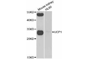 Western blot analysis of extracts of various cell lines, using UCP1 antibody (ABIN2560658) at 1:1000 dilution. (UCP1 Antikörper)