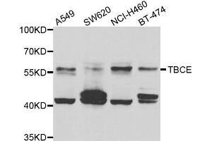 Western blot analysis of extracts of various cell lines, using TBCE antibody. (TBCE Antikörper)