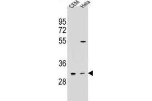 Western Blotting (WB) image for anti-Olfactory Receptor, Family 5, Subfamily L, Member 2 (OR5L2) antibody (ABIN2995999) (OR5L2 Antikörper)