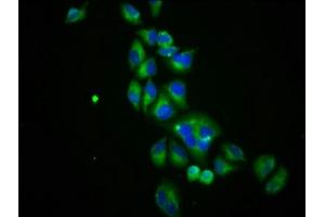 Immunofluorescence staining of Hela cells with ABIN7170075 at 1:100, counter-stained with DAPI. (SLC12A3 Antikörper  (AA 791-952))
