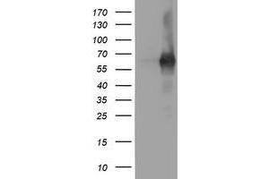 Western Blotting (WB) image for anti-phosphodiesterase 1B, Calmodulin-Dependent (PDE1B) antibody (ABIN1500073) (PDE1B Antikörper)
