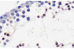 Immunohistochemistry of paraffin-embedded Mouse testis using HFM1 Polyclonal Antibody at dilution of 1:100 (40x lens). (HFM1 Antikörper)