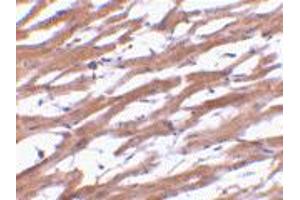 Immunohistochemistry of BCAP29 in human heart tissue with BCAP29 polyclonal antibody  at 10 ug/mL .