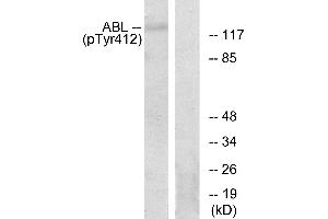Immunohistochemistry analysis of paraffin-embedded human brain tissue using Abl (Phospho-Tyr393/412) antibody. (ABL1 Antikörper  (pTyr393, pTyr412))