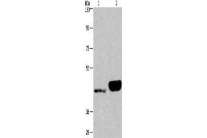 Gel: 6 % SDS-PAGE, Lysate: 40 μg, Lane 1-2: Human endometrial cancer tissue, Human placenta tissue, Primary antibody: ABIN7190562(ENPP4 Antibody) at dilution 1/200, Secondary antibody: Goat anti rabbit IgG at 1/8000 dilution, Exposure time: 40 seconds (ENPP4 Antikörper)