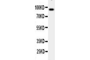 Anti-GCSF Receptor antibody, Western blotting WB: Human Placenta Tissue Lysate