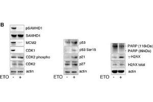 ETO regulates SAMHD1 phosphorylation through the p53, p21 pathwayMDM were treated with increasing concentrations of ETO and CTH. (p53 Antikörper  (N-Term))