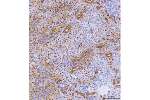 anti-Basic Leucine Zipper Transcription Factor, ATF-Like 2 (BATF2) (AA 1-138) antibody