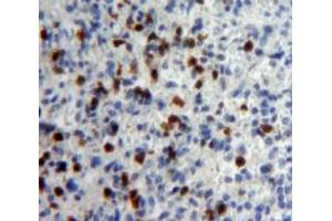 Used in DAB staining on fromalin fixed paraffin-embedded Spleen tissue (IFNA5 Antikörper  (AA 22-189))