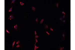 ABIN6268837 staining U-251 MG cells by IF/ICC. (Galectin 9 Antikörper  (Internal Region))