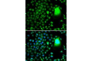 Immunofluorescence analysis of A-549 cells using TAF5 antibody. (TAF5 Antikörper  (AA 656-800))