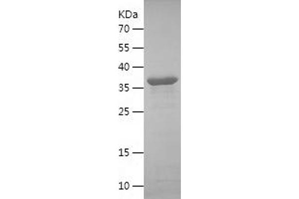 IREM1 Protein (AA 21-151) (His-IF2DI Tag)