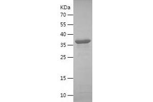 IREM1 Protein (AA 21-151) (His-IF2DI Tag)