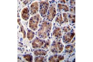 Immunohistochemistry (Paraffin-embedded Sections) (IHC (p)) image for anti-Mannosidase, Alpha, Class 2A, Member 2 (MAN2A2) (AA 766-796), (Middle Region) antibody (ABIN953290)