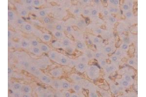 IHC-P analysis of Rat Liver Tissue, with DAB staining. (Fibrinogen beta Chain Antikörper  (AA 33-479))