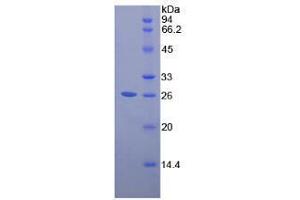 SDS-PAGE analysis of Human Pepsinogen A Protein. (Pepsinogen A Protein)