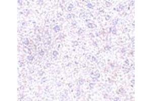 Immunohistochemistry of TEM7 in mouse liver tissue with this product at 2. (PLXDC1 Antikörper  (C-Term))