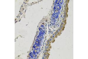 Immunohistochemistry of paraffin-embedded mouse lung using GAS6 antibody. (GAS6 Antikörper)