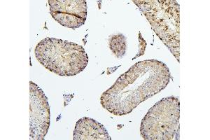 IHC analysis of TEK using anti-TEK antibody (ABIN7600762). (TEK Antikörper  (AA 23-616))