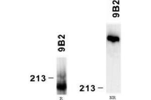 Western Blotting (WB) image for anti-Laminin, alpha 4 (LAMa4) antibody (ABIN781771) (LAMa4 Antikörper)