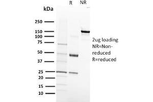 SDS-PAGE Analysis Purified VEGF-R1 Mouse Monoclonal Antibody (FLT1/658). (FLT1 Antikörper)