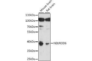 Western blot analysis of extracts of various cell lines, using NEUROD6 antibody (ABIN7268868) at 1:1000 dilution. (NEUROD6 Antikörper  (AA 188-337))