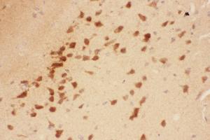 Anti-BDNF Picoband antibody,  IHC(P): Rat Brain Tissue (BDNF Antikörper  (AA 129-247))