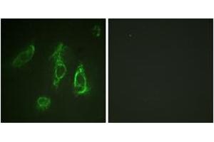 Immunofluorescence analysis of HeLa cells, using Epo-R (Ab-368) Antibody. (EPOR Antikörper  (AA 341-390))