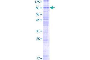 SLC17A7 Protein (AA 1-560) (GST tag)