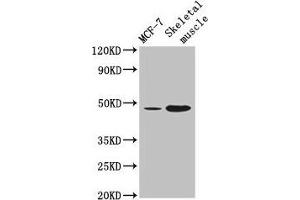 Western Blot Positive WB detected in: MCF-7 whole cell lysate, Mouse skeletal muscle tissue All lanes: ARRDC3 antibody at 4 μg/mL Secondary Goat polyclonal to rabbit IgG at 1/50000 dilution Predicted band size: 47 kDa Observed band size: 47 kDa (ARRDC3 Antikörper  (AA 1-270))