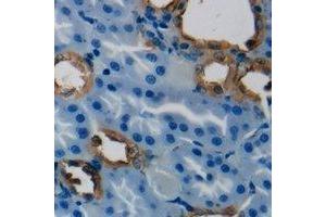 Immunohistochemical analysis of HSD3B7 staining in human kidney formalin fixed paraffin embedded tissue section.