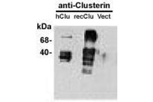 Image no. 1 for anti-Clusterin (CLU) antibody (ABIN187541) (Clusterin Antikörper)