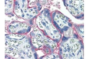 Human Placenta (formalin-fixed, paraffin-embedded) stained with c-Metat 15 µg/ml followed by biotinylated goat anti-rabbit IgG secondary antibody, alkaline phosphatase-streptavidin and chromogen. (c-MET Antikörper  (C-Term))