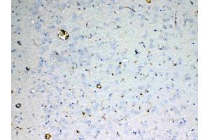 IHC analysis of ADA using anti-ADA antibody . (ADA Antikörper  (AA 2-241))