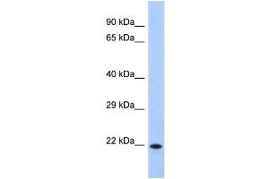 Western Blotting (WB) image for anti-Coiled-Coil Domain Containing 27 (CCDC27) (N-Term) antibody (ABIN2785189) (CCDC27 Antikörper  (N-Term))