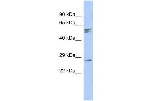 RD3 antibody used at 1 ug/ml to detect target protein. (RD3 Antikörper  (N-Term))