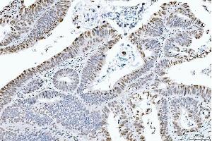 IHC analysis of CTBP2 using anti-CTBP2 antibody (ABIN7601325).