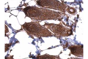 IHC-P Image EIF3D antibody detects EIF3D protein at cytosol on mouse skin by immunohistochemical analysis. (EIF3D Antikörper)