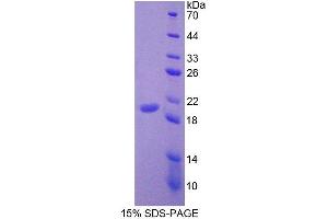 Image no. 1 for Leukocyte Cell-Derived Chemotaxin 2 (LECT2) (AA 1-151) protein (His tag) (ABIN4990433)