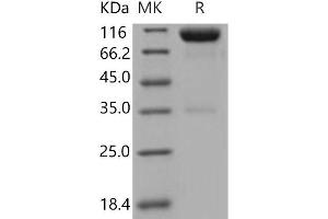 Western Blotting (WB) image for AXL Receptor tyrosine Kinase (AXL) protein (His tag,Fc Tag) (ABIN7320398) (AXL Protein (His tag,Fc Tag))