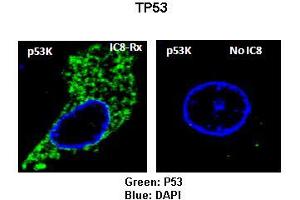 Sample Type: Rat thyrocytes-FRTL-5  Primary Antibody Dilution: 1:100 Secondary Antibody: Anti-rabbit-FITC  Secondary Antibody Dilution: 1:000 Color/Signal Descriptions: Green: TP53RKBlue: DAPI  Gene Name: TP53RK Submitted by: Syed A Morshed, Mount Sinai School of Medicine and James J Peters VA Medical Center (TP53RK Antikörper  (N-Term))