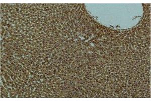 Immunohistochemistry of paraffin-embedded Rat liver tissue using PI 3 kinase p85 alpha Monoclonal Antibody at dilution of 1:200. (PIK3R1 Antikörper)