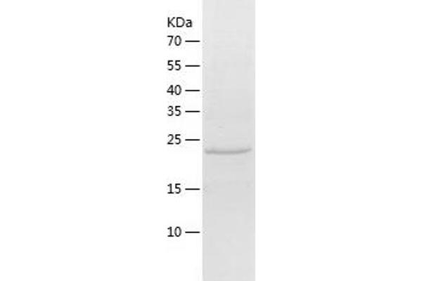 USP12 Protein (AA 165-370) (His tag)