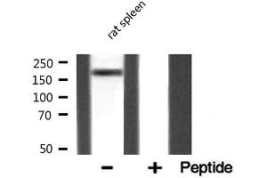 Western blot analysis of MAST2 expression in Rat spleen lysate